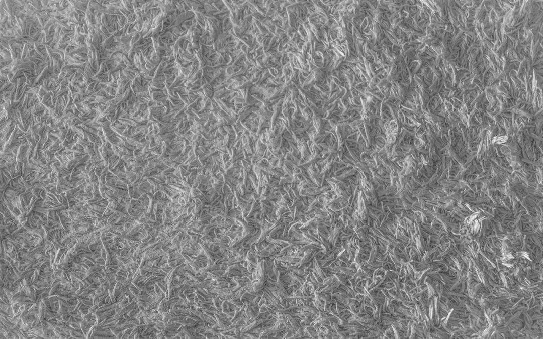 5 Signs That Indicate Your Area Rug Needs to Be Cleaned